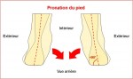 Talonnettes pour corriger la pronation 2