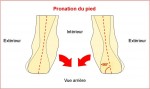 Talonnettes pour corriger la pronation 2