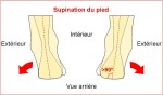 Talonnettes pour corriger la supination 2