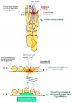 Semelles pour douleurs de l'avant pied 3